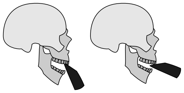 Left: clarinet jaw position (more open). Right: saxophone jaw position (less open).
